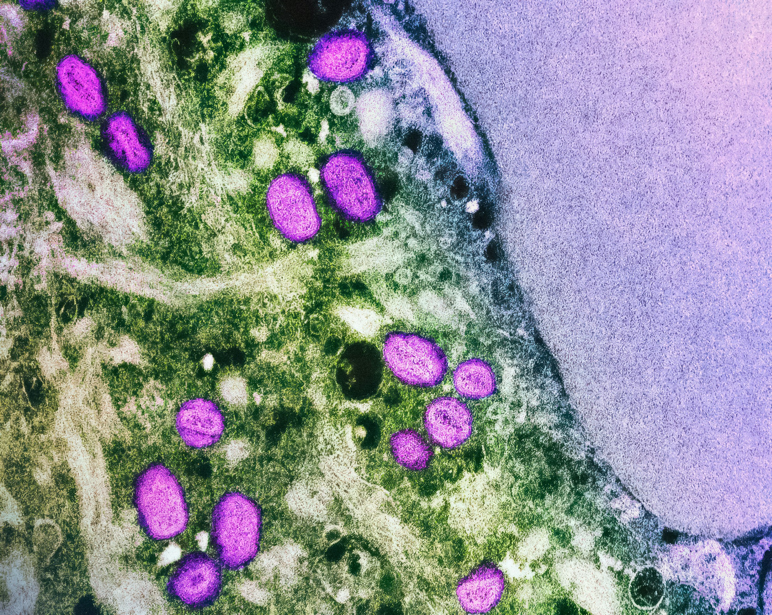 From Gut to Cochlea: The Microbiome–Hearing Connection (What the Science Actually Says)