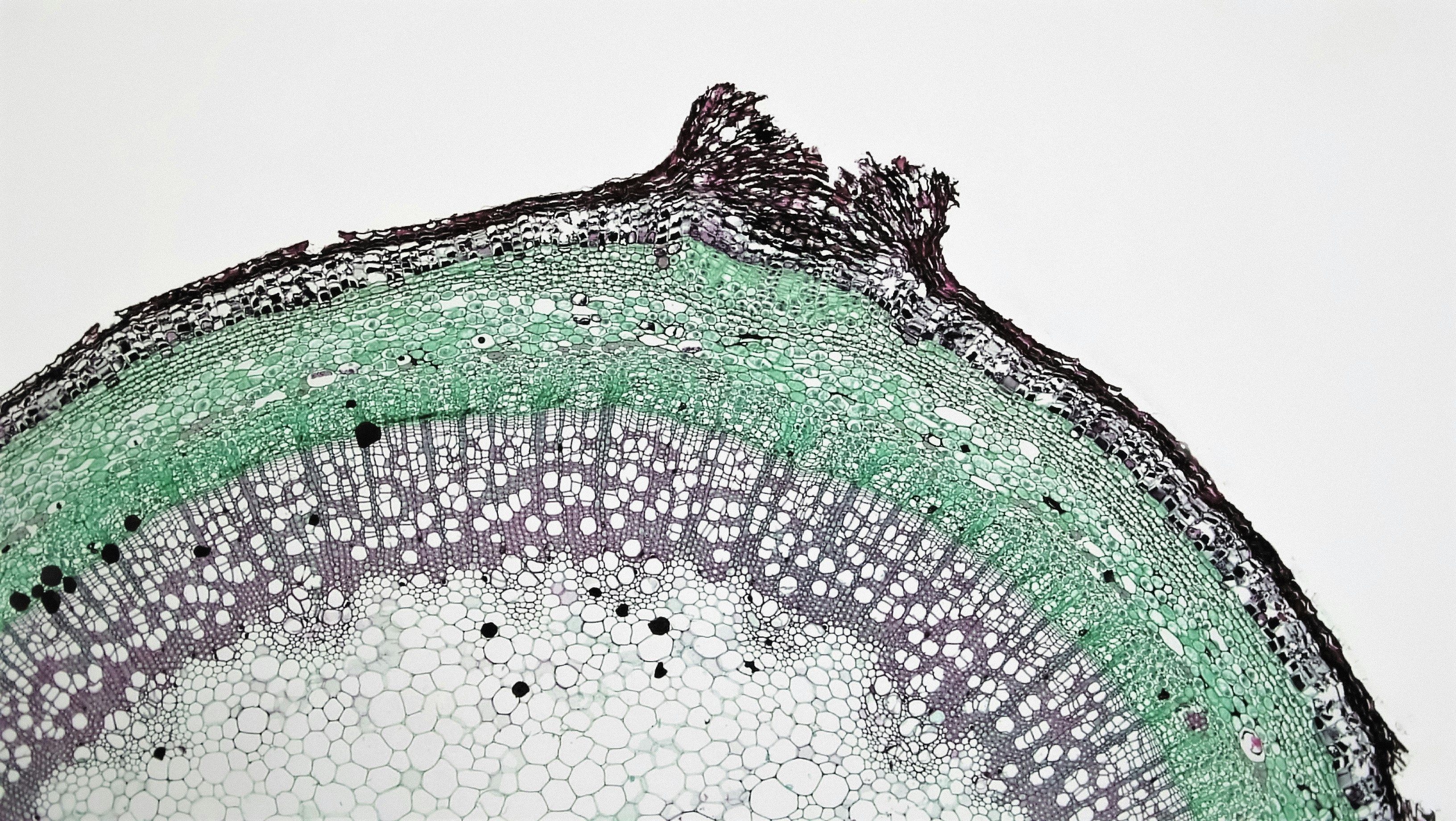 Can We Regrow Hearing? The Real State of Hair Cell Regeneration